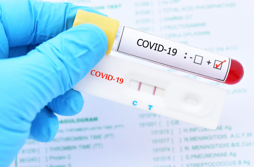 Salud Pública notifica 535 contagios y siete muertes por coronavirus